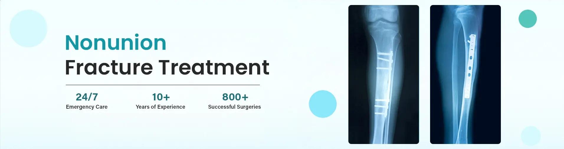 Best non-union fracture treatment in Gurgaon