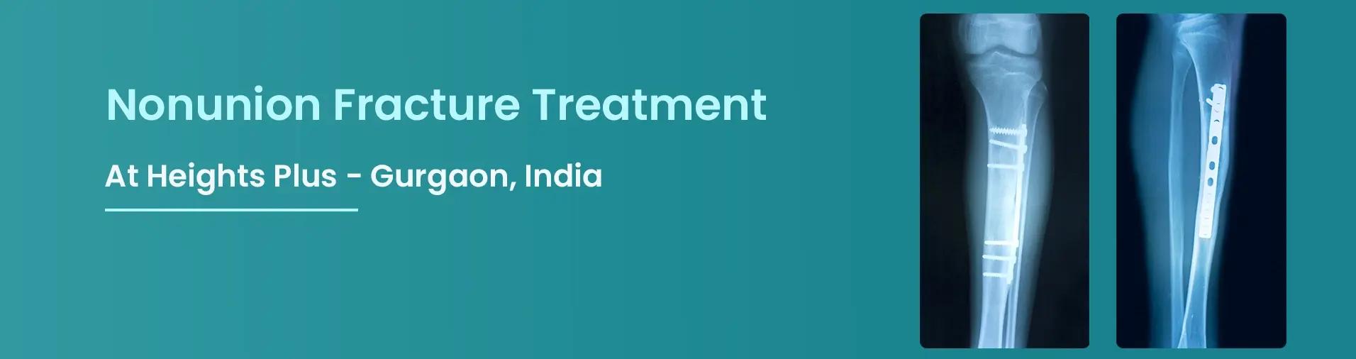 Best non-union fracture treatment in Gurgaon