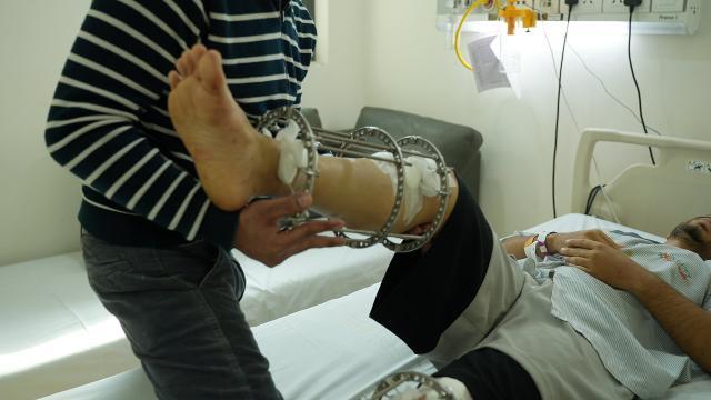 Doctor showing progress measurements during follow-up visit