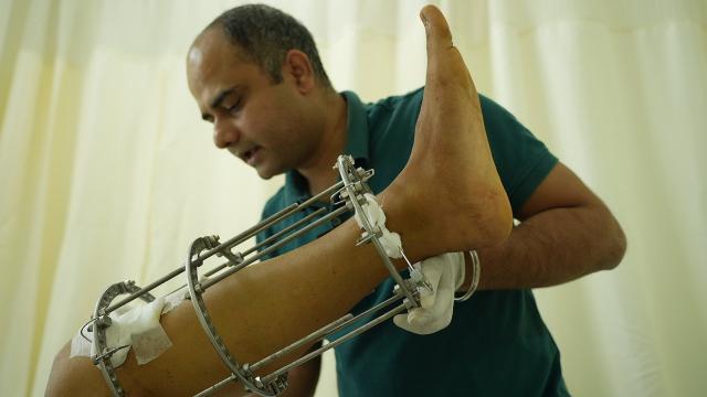 Clinical rehabilitation environment for limb lengthening care