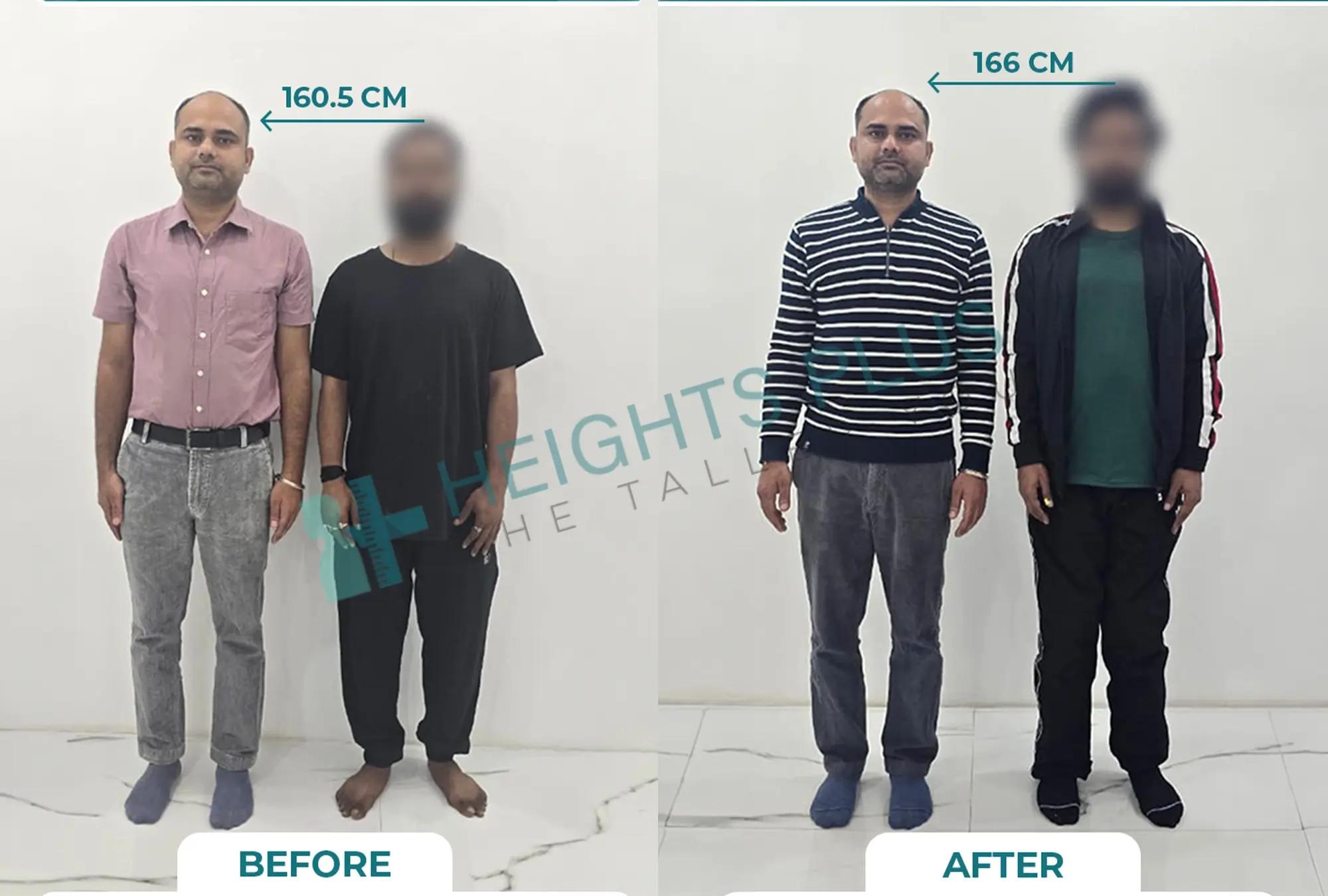 Dr. S.S. Mohapatra - Leading limb lengthening surgery specialist in India