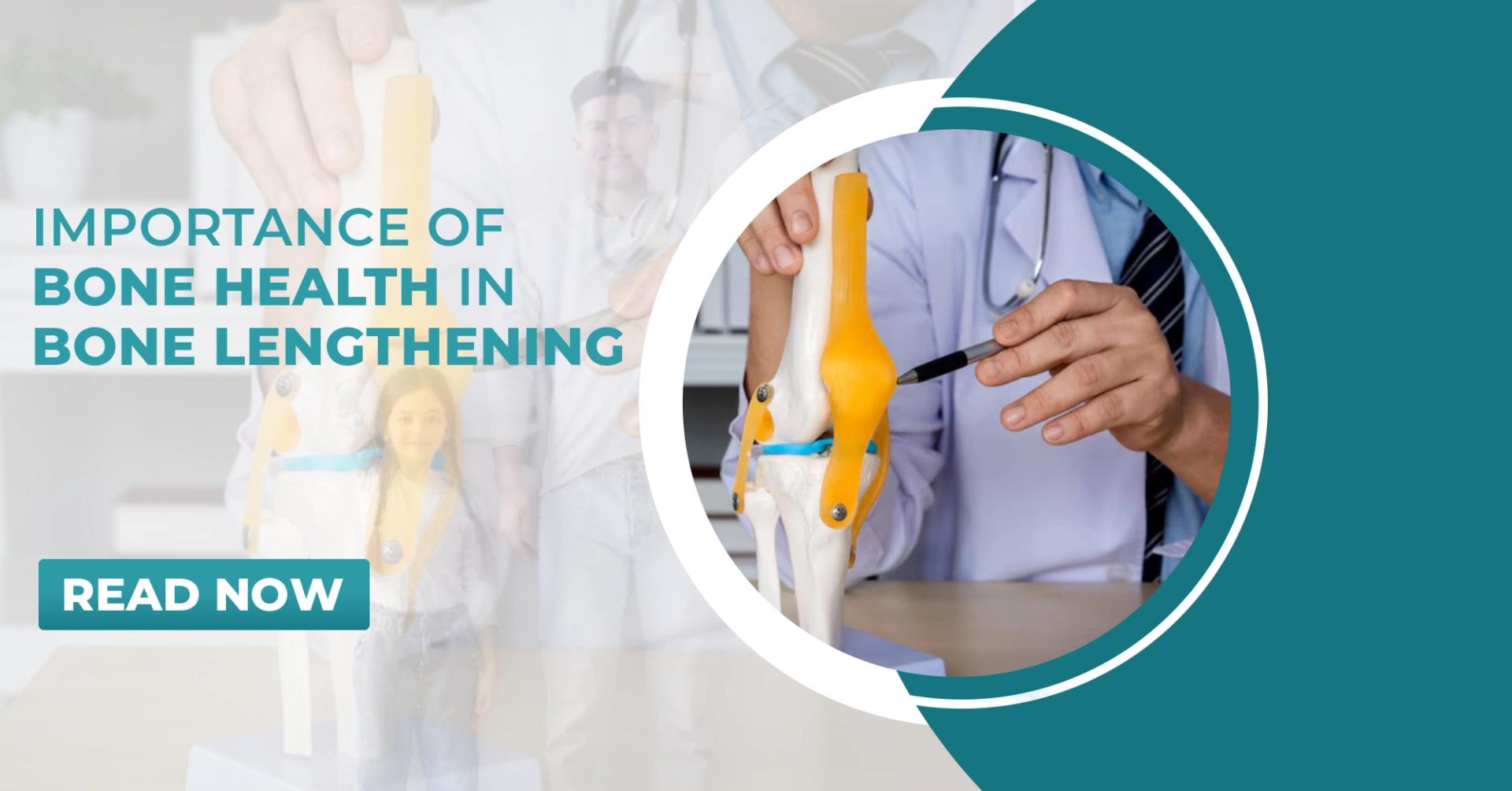 Importance of Bone Health in Bone Lengthening