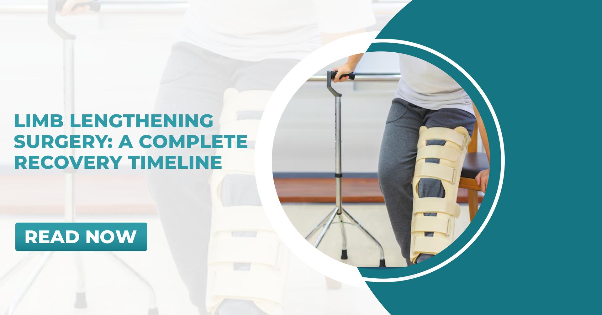 Limb Lengthening Surgery