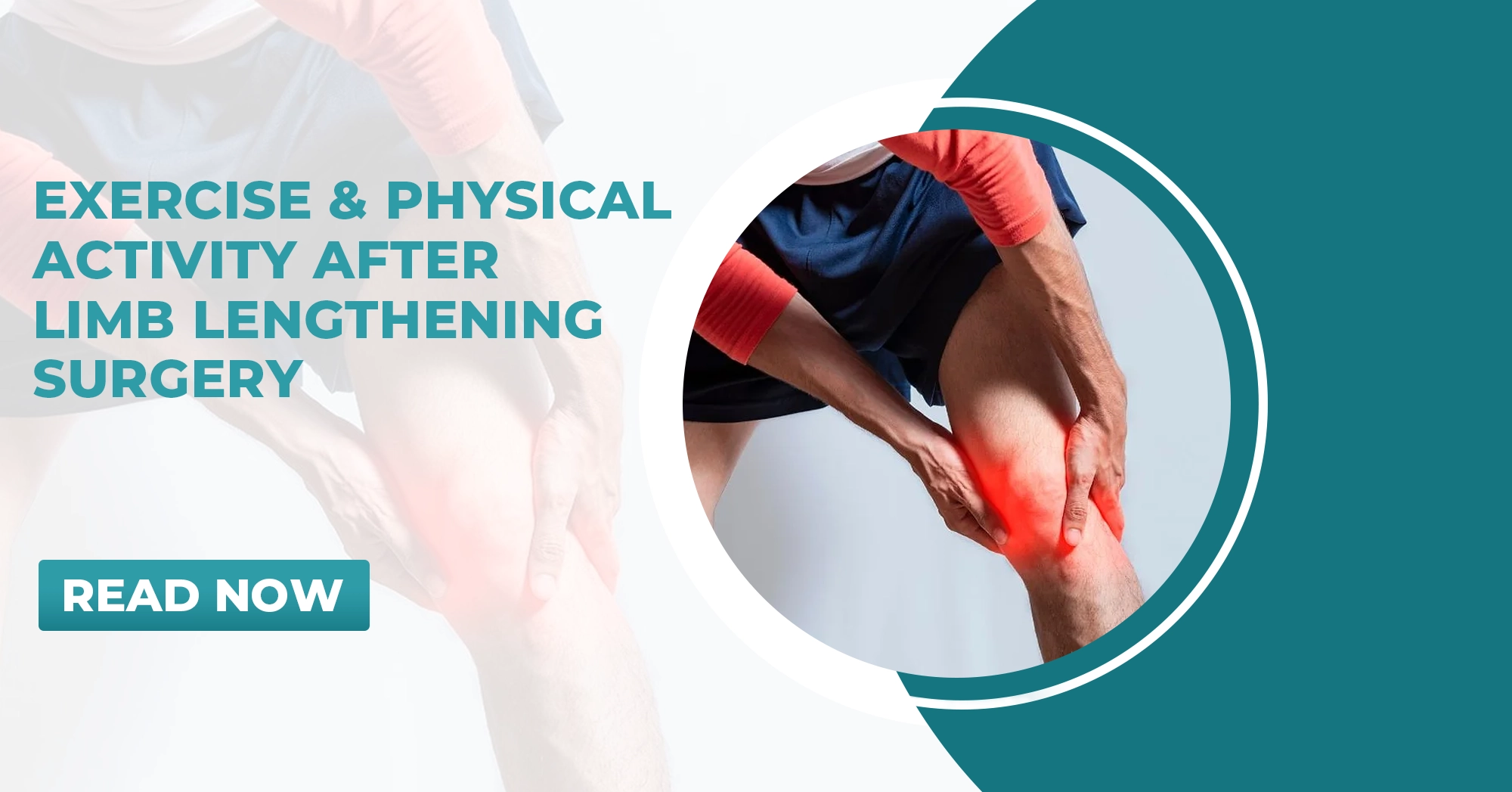 Exercise and Recovery After Limb Lengthening Surgery